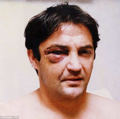 Gary mabbutt injury